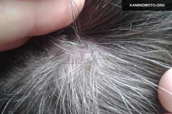 Có nên nhổ tóc bạc không